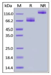 Human B7-2, Fc Tag on SDS-PAGE under reducing (R) and non-reducing (NR) conditions. The gel was stained overnight with Coomassie Blue. The purity of the protein is greater than 95%.